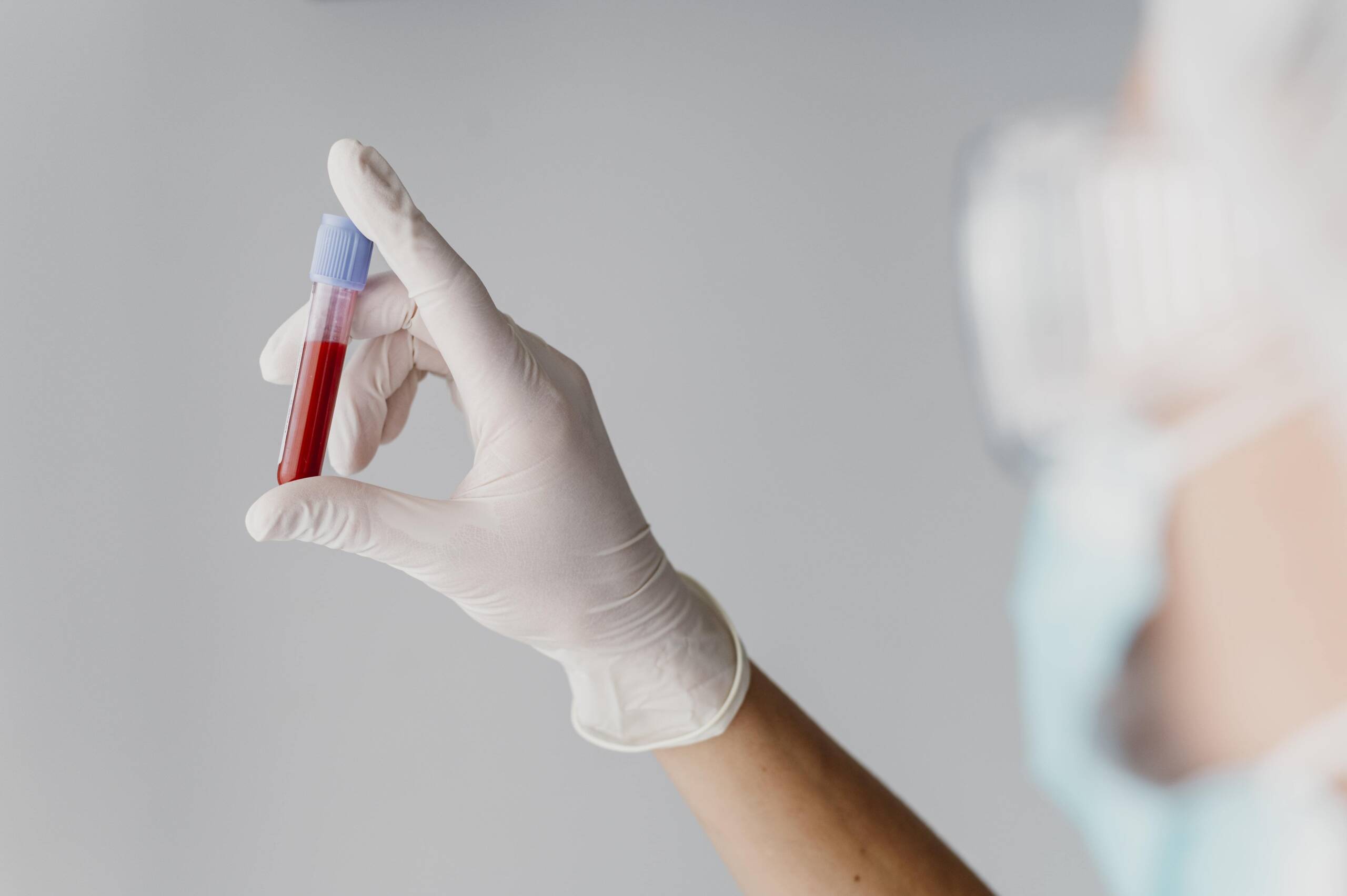 Medical worker holds single blood sample in glove